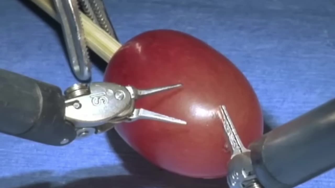 Surgery on a Grape? Precision with da Vinci System!