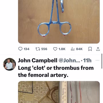 John Campbell Clot Shot 💉🤬