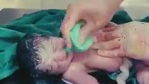 DOCTORS DESPERATELY TRY TO SAVE THE LIFE OF A NEW BORN BABY-AND THEY MANAGE TO