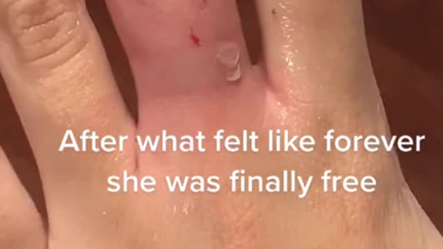 The Time A Girl got A Ring Stuck On Finger #shorts #Girls #ring