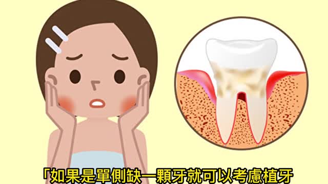 植牙看體質 非人人合適