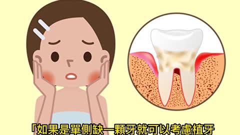 植牙看體質 非人人合適