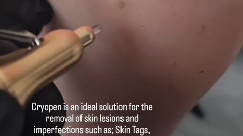 To achieve your ideal skin