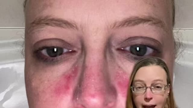 This is just ONE of the many things this product is good for !