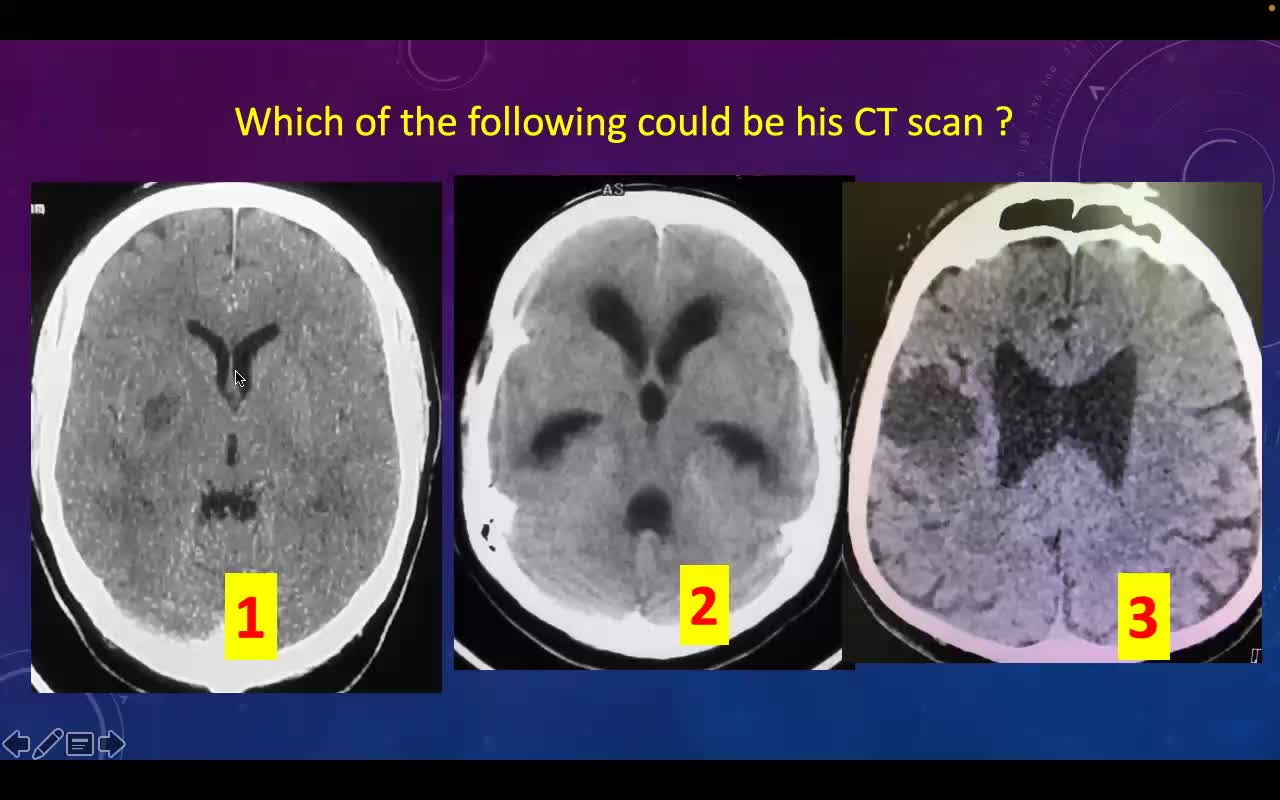 Neurovascular disorders - 13