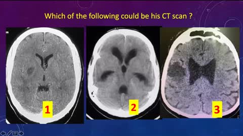 Neurovascular disorders - 13