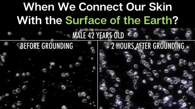 What Happens When We Connect Our Skin With the Surface of the Earth?