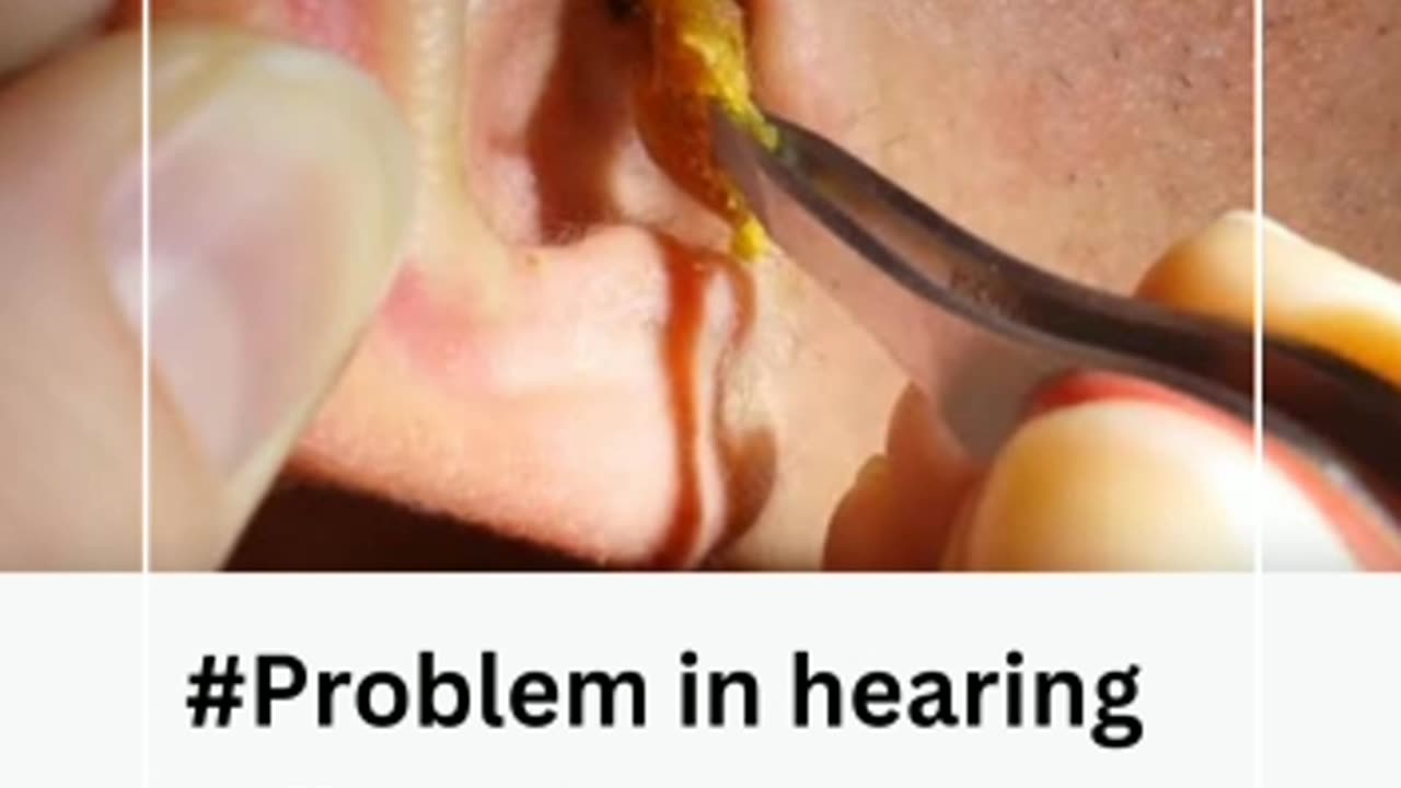 do you have any ear problem? in 2023 sonnofit review