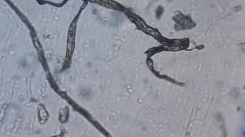 5G morgellon artificial structures are found in the Pfizer vaccine under 300x amplification