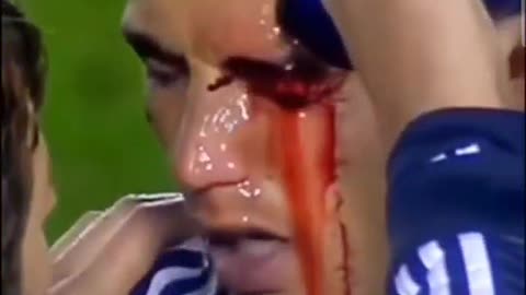 Cristiano Ronaldo After Injury