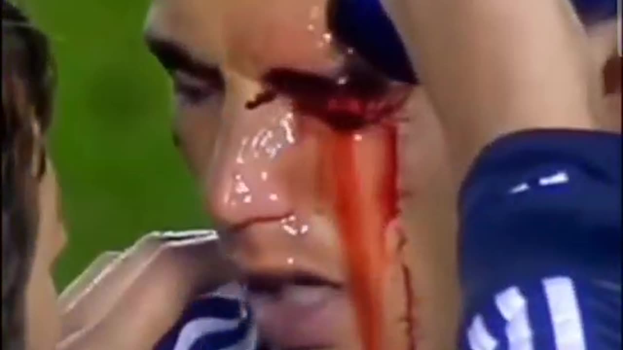 Cristiano Ronaldo After Injury