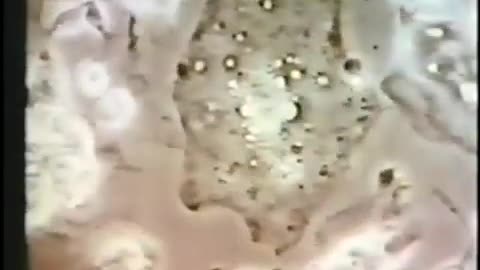 The Cancer Answer By Medical Journalist Albert Carter Part 2of4