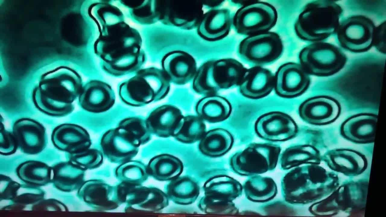 #68 AMAZING!!! Molecular H2 Hydrogen BLOOD SAMPLE from 2018 LOURDES HYDROFIX