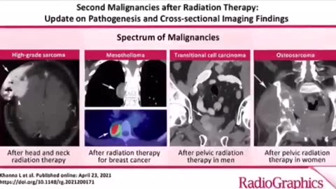Nanocapsels-What is in the jab?