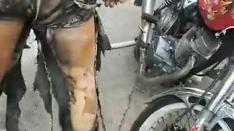 Man catches fire because the prosecutor does not give an answer to his case