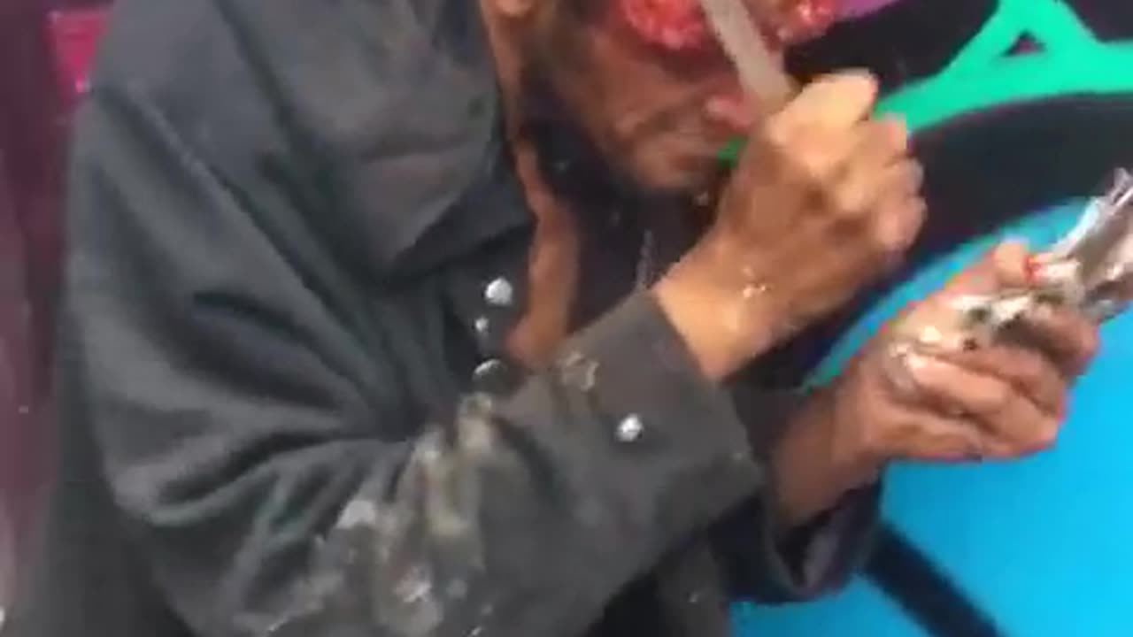 Homeless Man Carves Own Skull...