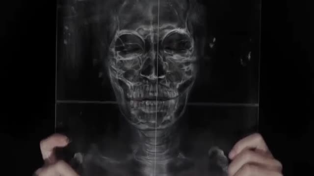 X-ray skull