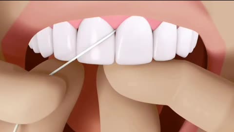 Dental health