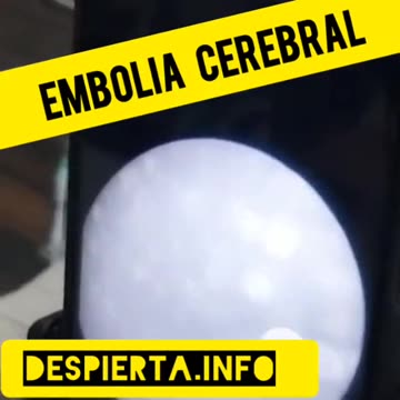 Dr. Liliana Zelada discovers graphene in the recombinant tetravalent HPV