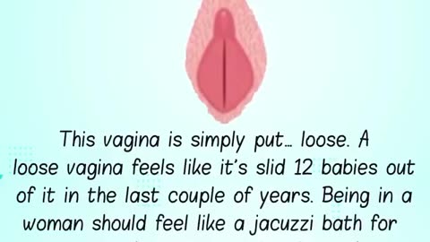 Top 10 Vagina's