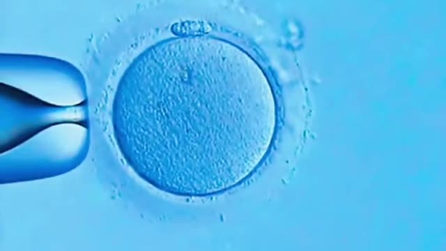 ICSI second generationIVF technology