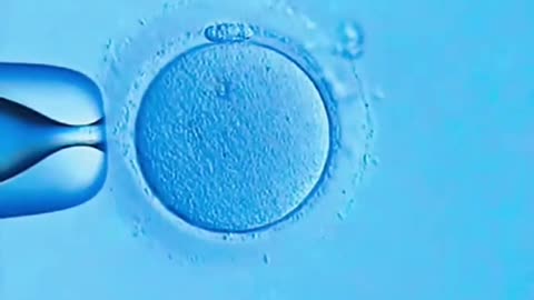 ICSI second generationIVF technology