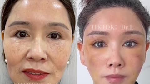 To achieve your ideal skin