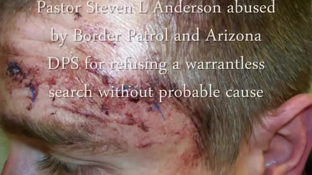 Slideshow Baptist Pastor Beaten & Tazed by Border Patrol - sanderson1611 Channel Revival