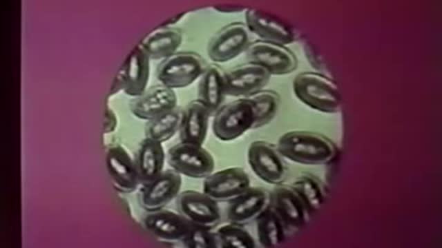 World Without Cancer; The Story of Vitamin B17