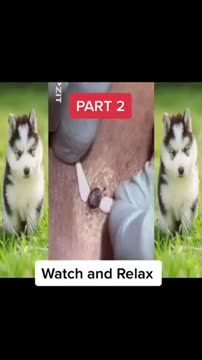 Pimple Popping 2021 - Blackheads & Whiteheads