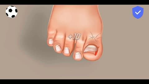 Ingrown Toenail ASMR