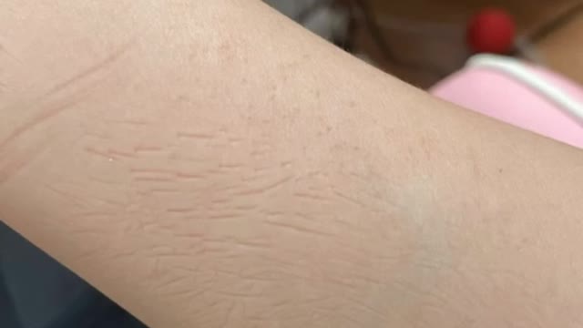 Hedgehog loves staying on my arm and hands