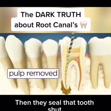 The Dark Truth About Root Canal