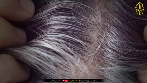 Sar ka Baal girain ya sufaid hon to aik cheez lag lo /long and thick hair remedy