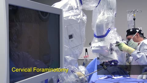 Cervical Foraminotomy