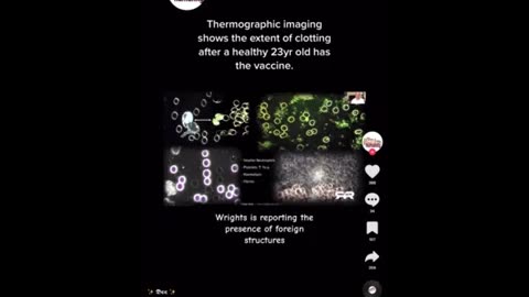 Gregg Reese on thermo imaging and the jab ..