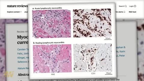 CHILDREN ARE INJURED AND KILLED BY THE VAX. WHAT ARE WE DOING? DR RYAN COLE