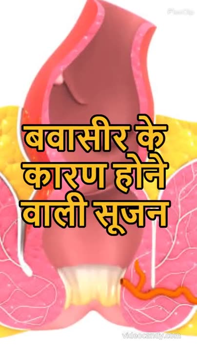 Many Benefits Of radish