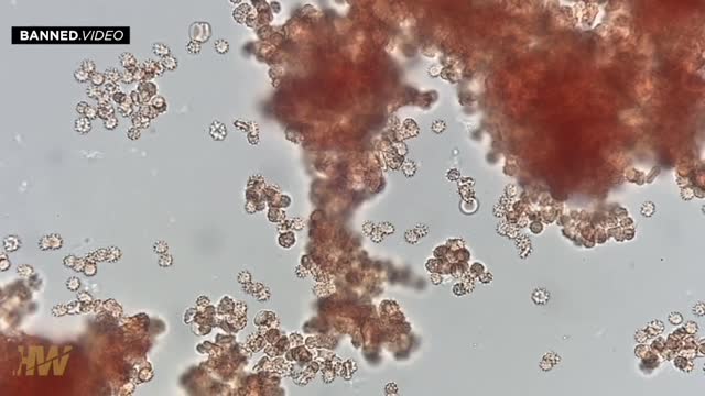 View Real Time Interaction Between Human Blood and Covid Jab