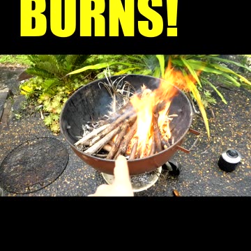 Everything BURNS!