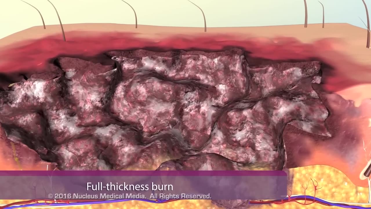 BURN...An emergency situation #classified Information...must watch