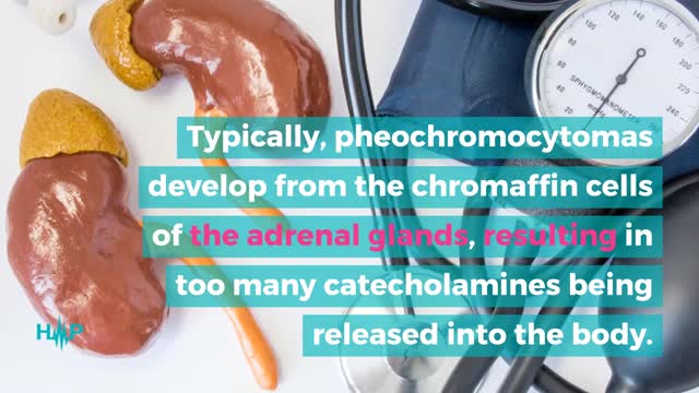 Risk Factors And Causes For A Pheochromocytoma