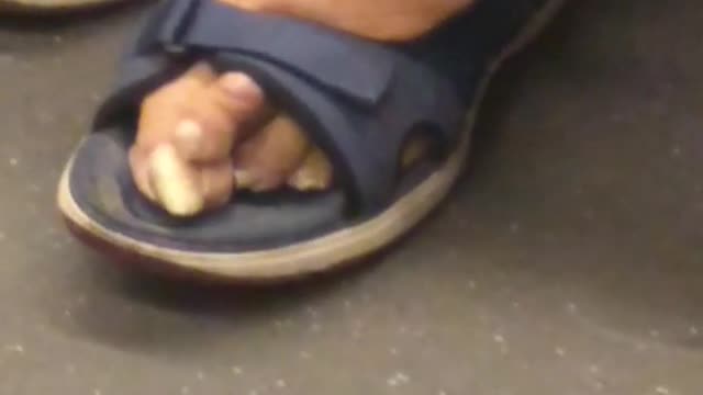 Woman wearing sandals on subway train has ugly looking feet, huge crooked big toe