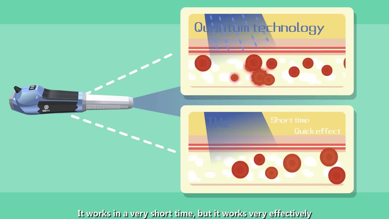 Terahertz - How does it work