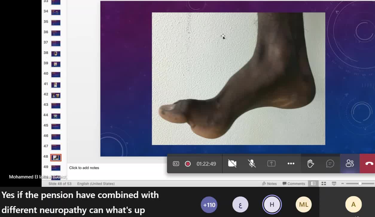 ST3.Cerebellar syndromes Lahawi
