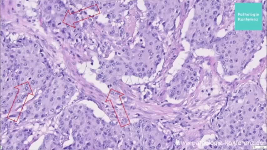 2. Pathologie Konferenz TODESFÄLLE & GESUNDHEITLICHE SCHÄDEN