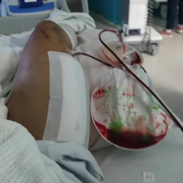 [VAX GENOCIDE] One more for the NWO agenda