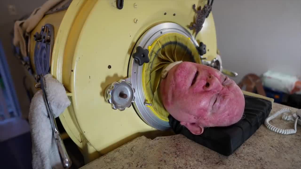 The man in the iron lung ( an example of never give up )