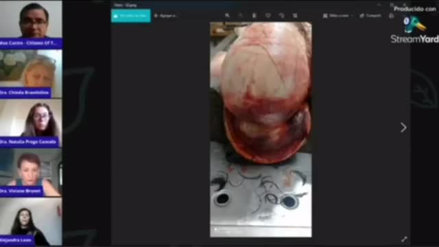 La autopsia a un inoculado que realizó la Dra. Chinda Brandolino.