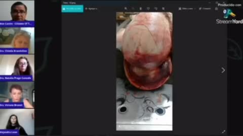 La autopsia a un inoculado que realizó la Dra. Chinda Brandolino.